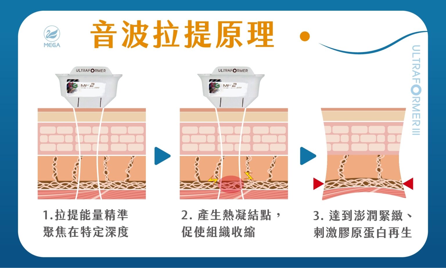 音波拉提原理
