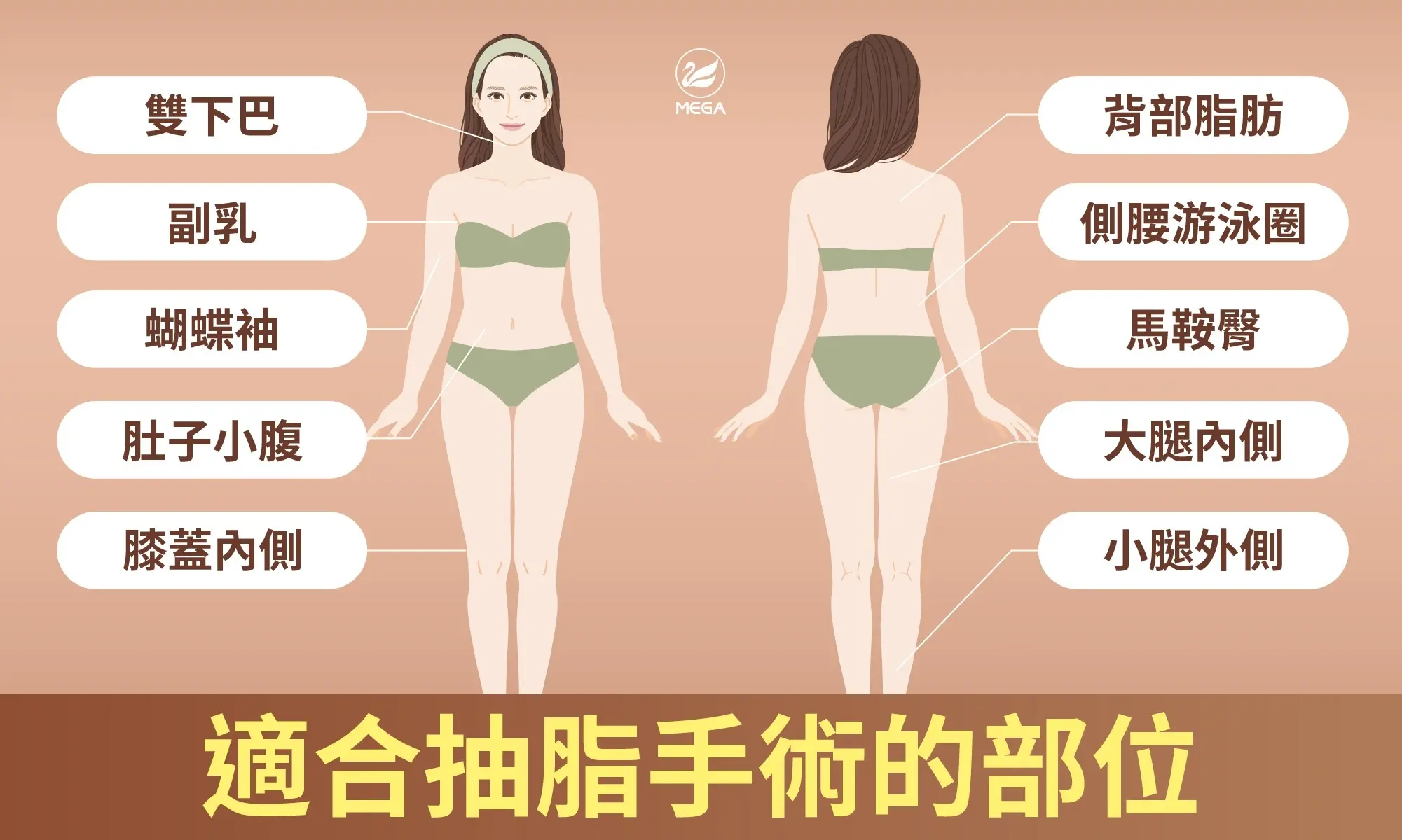 適合抽脂手術的部位，雙下巴、蝴蝶袖、副乳、肚子小腹、膝蓋內側、背部脂肪、側腰游泳圈、大腿內側、馬鞍臀、小腿外側