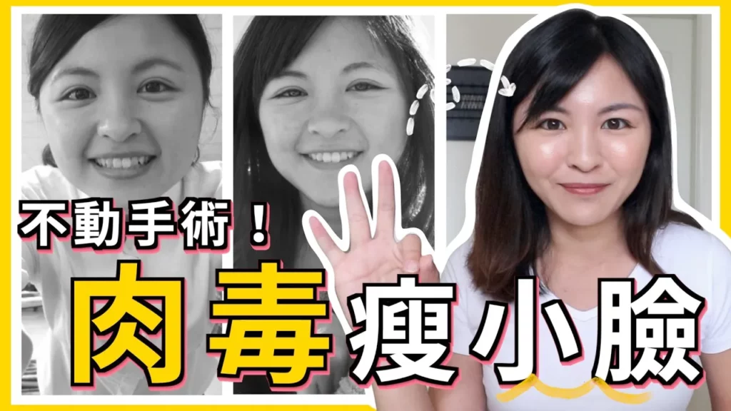 【玩美影音】圓臉女孩的救星！肉毒瘦小臉～國字臉掰掰