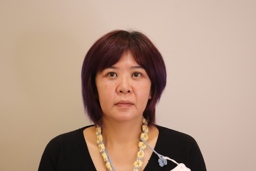 眼袋手術案例