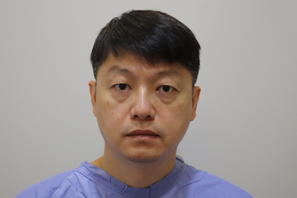 眼袋手術案例