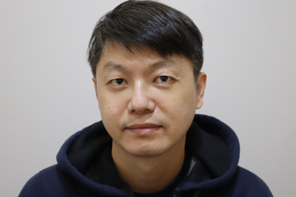 眼袋手術案例