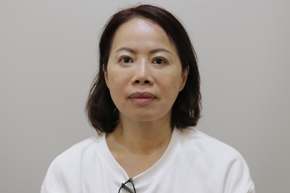 眼袋手術案例