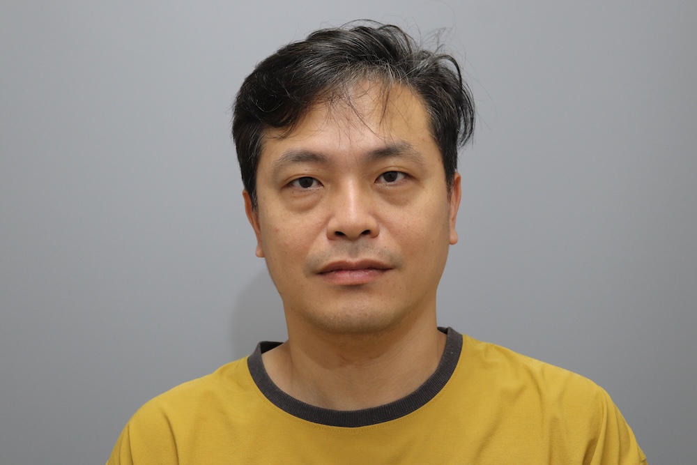 眼袋手術案例