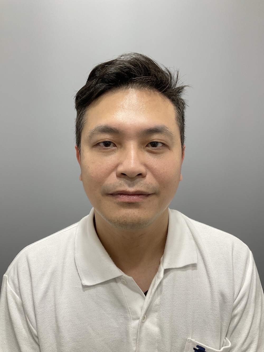 眼袋手術案例