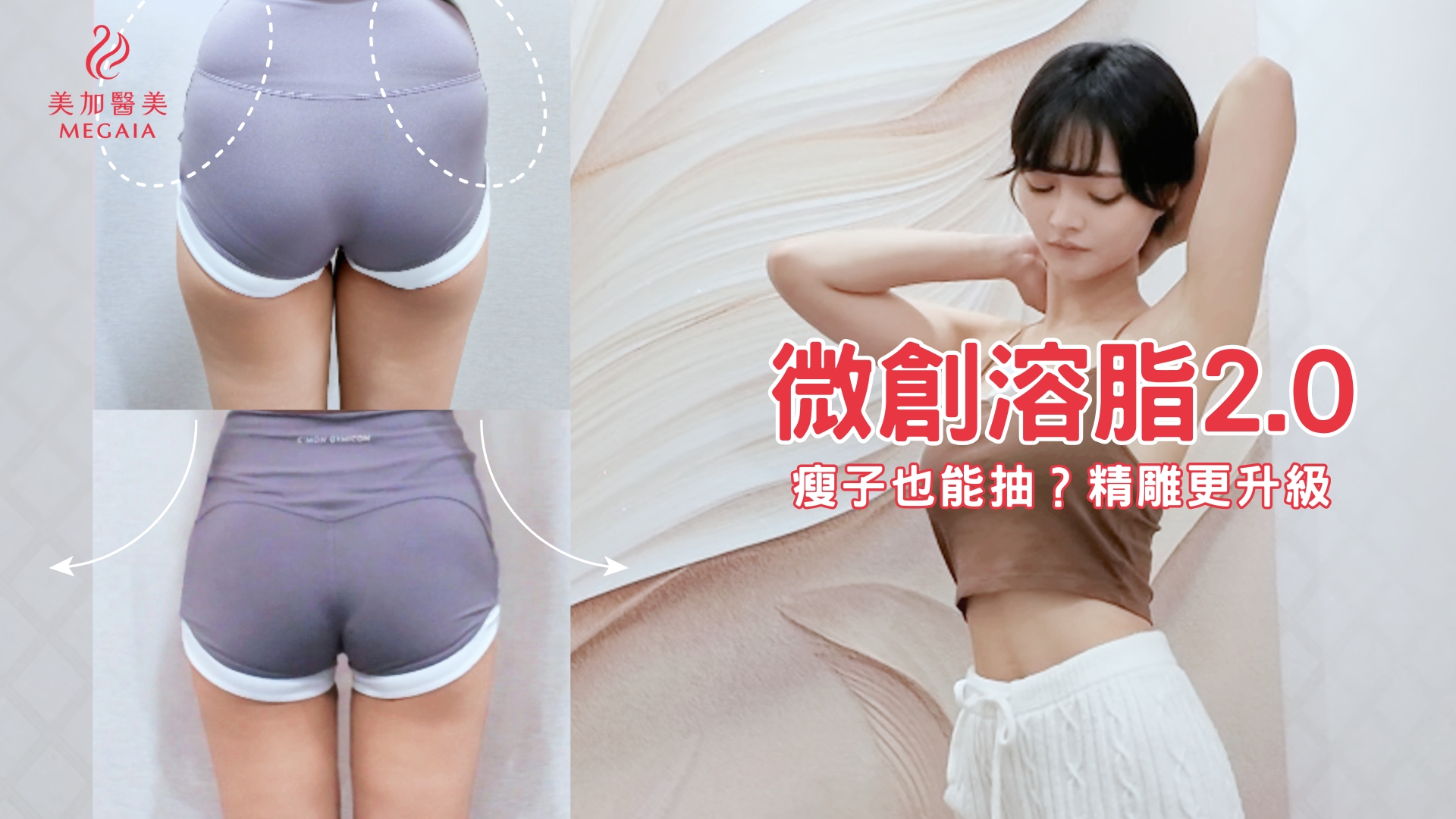 運動難瘦的局部線條，微創溶脂 2.0 找回腰線與大腿縫 | 美加醫美