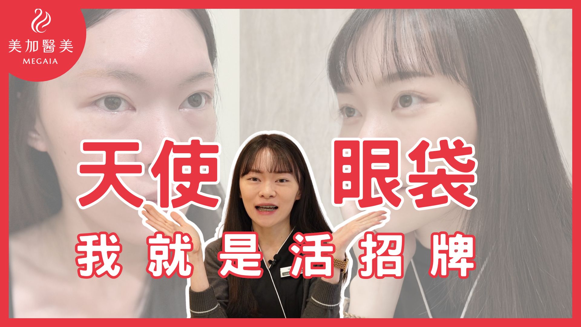 4D精密眼袋撫平術，讓我成為最亮眼的新娘 | 美加醫美